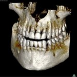 КТ челюсти и КТ зубов: это разные исследования?