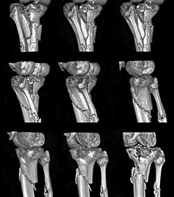 Компьютерная томография трубчатых костей